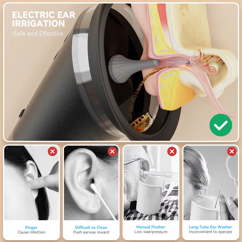 Electric Ear Wax Removal System Water Powered Ear Cleaning Tool with Irrigation Flusher 3 Pressure Settings Safe & Effective